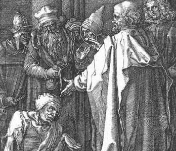 Engraving "The leprose" by Albrecht Dürer. Created in 1513. cc: Wikipedia